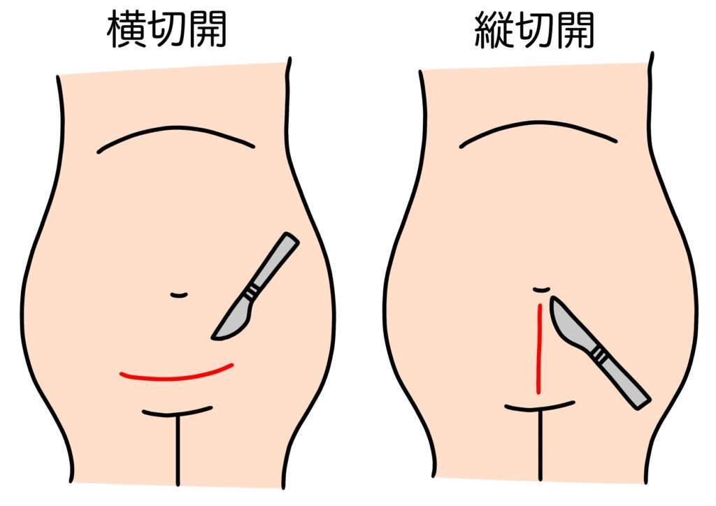 傷あとのケアってしていますか？